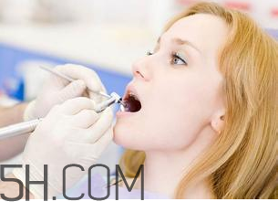 洗牙的危害和好处,洗牙的危害性有哪些 洗牙的危害和好处,洗牙的危害性有哪些