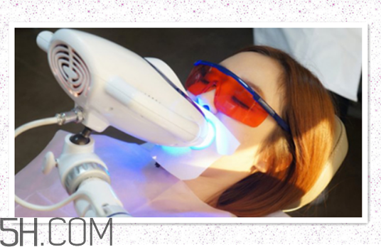 超声波洗牙后注意事项,超声波洗完牙要注意什么 超声波洗牙后注意事项,超声波洗完牙要注意什么