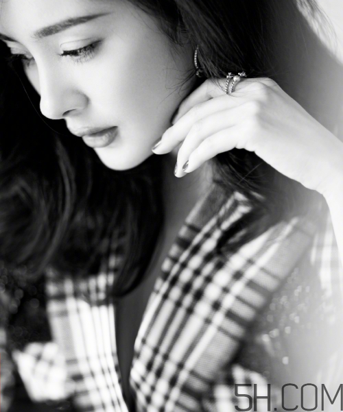 去眼袋手术恢复期多久,做眼袋手术多久能恢复正常 去眼袋手术恢复期多久,做眼袋手术多久能恢复正常