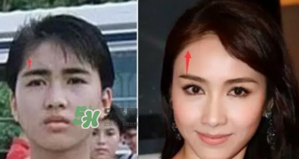 如何把发际线变低,让发际线变低的方法