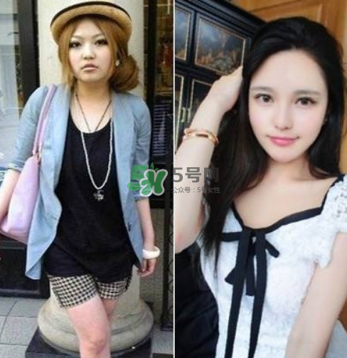 周扬青整容阶段,周扬青怎么瘦的