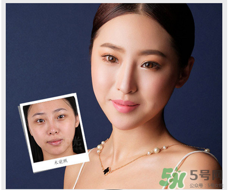 玻尿酸填充泪沟多少钱一次,玻尿酸填充泪沟多少钱一支