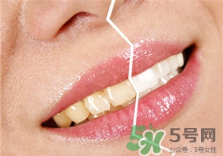 氟斑牙是怎么形成的原因,氟斑牙的病因