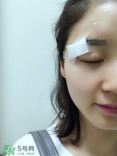 冷冻点痣的危害,冷冻点痣后要注意什么 冷冻点痣的危害,冷冻点痣后要注意什么