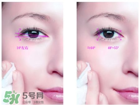 开眼角后可以吃酱油吗,开眼角忌口多久 开眼角后可以吃酱油吗,开眼角忌口多久