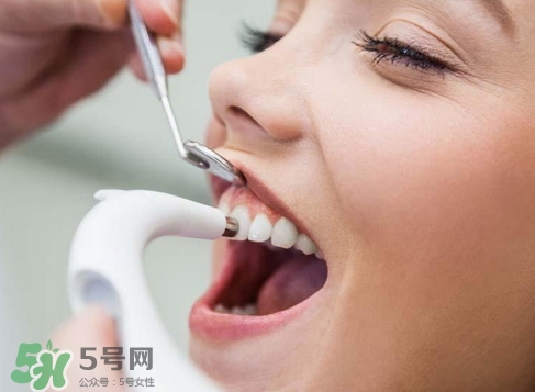 洗牙的好处和坏处有哪些?,洗牙的好处有哪些 洗牙的好处和坏处有哪些?,洗牙的好处有哪些