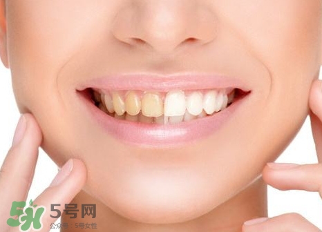 补牙后脱落是什么原因,补牙材料脱落的原因