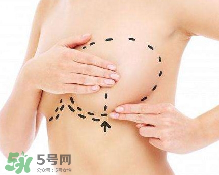 隆胸对身体有伤害吗,隆胸手术有什么危害和后遗症吗