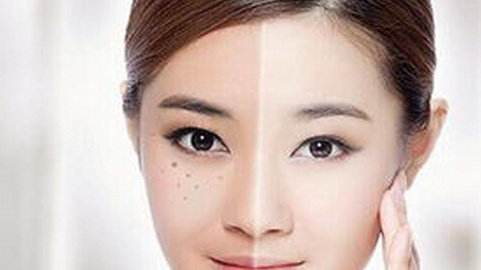 激光祛斑有什么副作用吗?,激光祛斑效果怎么样会有副作用吗