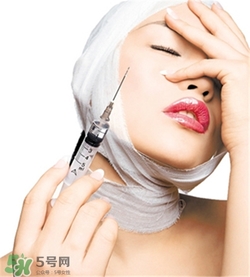 玻尿酸除皱效果怎么样多久才能见效,玻尿酸除皱有效果吗 玻尿酸除皱效果怎么样多久才能见效,玻尿酸除皱有效果吗