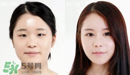 做双眼皮的危害割双眼皮的坏处,割双眼皮有哪些危害性 做双眼皮的危害割双眼皮的坏处,割双眼皮有哪些危害性