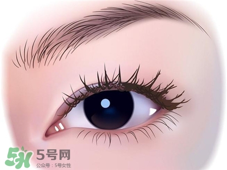 吸雕双眼皮是什么,吸雕双眼皮是什么意思