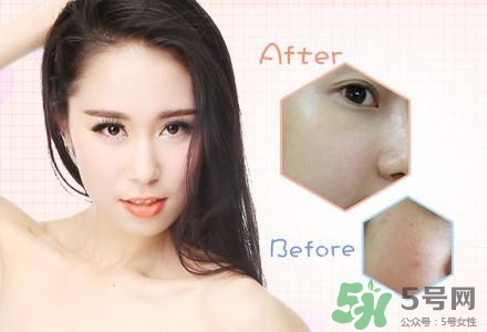 水氧嫩肤效果怎么样,水氧嫩肤是什么