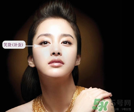 打完卧蚕要几天消肿,打了卧蚕什么时候消肿