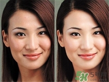 白瓷娃娃能保持多久,白瓷娃娃恢复期多长