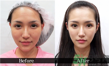 怎么缓解术后疼痛难忍,怎么缓解术后疼痛感