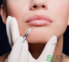自体脂肪丰唇能保持多久,自体脂肪丰唇恢复期