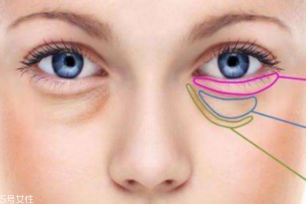 做手术有什么禁忌吗,做手术最忌讳什么