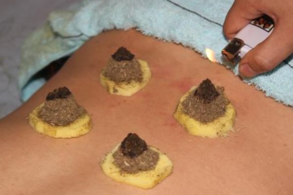 为什么艾灸可以减肥,艾灸为什么能减肥