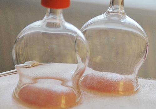 肚子拔罐减肥几天拔一次最好,减肥拔罐多长时间合适