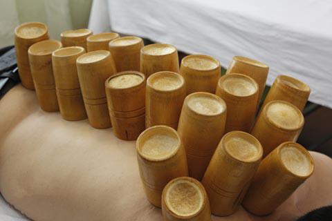 拔罐减肥需要控制饮食吗,拔罐到底能不能减肥