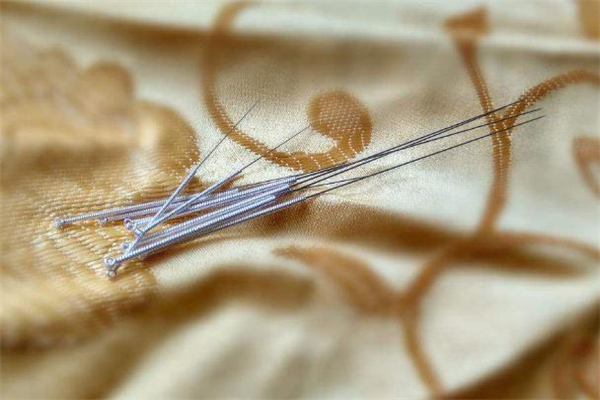 针灸减肥和按摩减肥哪个效果好,针灸减肥效果好吗 针灸减肥和按摩减肥哪个效果好,针灸减肥效果好吗