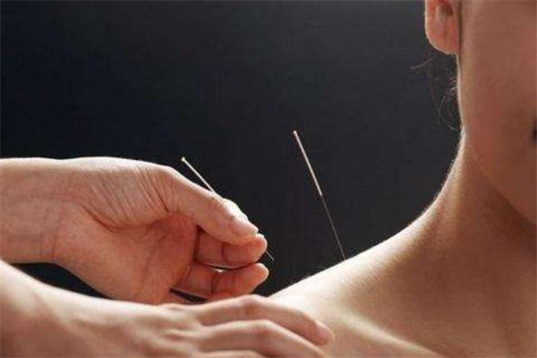 针灸减肥会影响怀孕吗,针灸减肥期间怀孕了小孩可以要吗