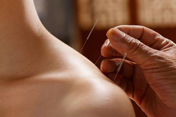 针灸减肥会不会反弹,针灸减肥有效果吗?会反弹吗