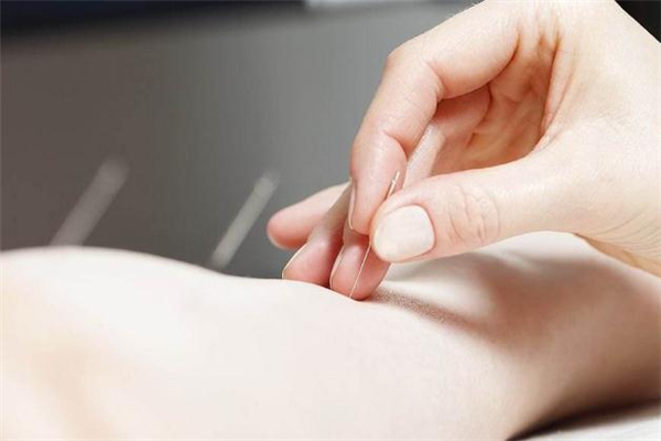 针灸减肥20斤需要多久,针灸减肥20斤需要多久去什么医院