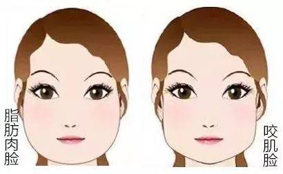 咬肌肥大是天生的吗,天生咬肌肥大怎么办