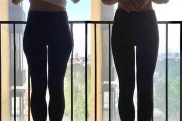 假胯宽能减掉吗,假胯宽怎么减