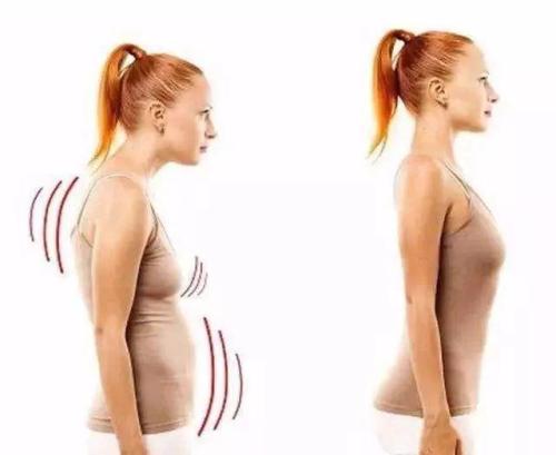 怎样防止驼背现象,驼背怎么造成的