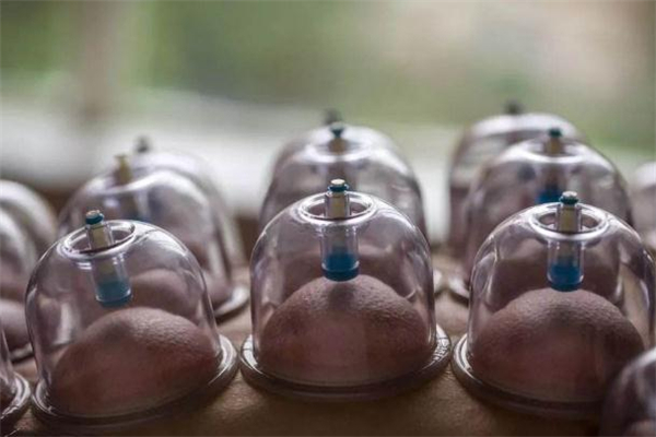 拔罐减肥有科学依据吗?,所谓的拔罐减肥是真的有效吗 拔罐减肥有科学依据吗?,所谓的拔罐减肥是真的有效吗