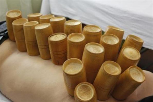 拔罐减肥有坏处吗,拔罐减肥有坏处吗会反弹吗