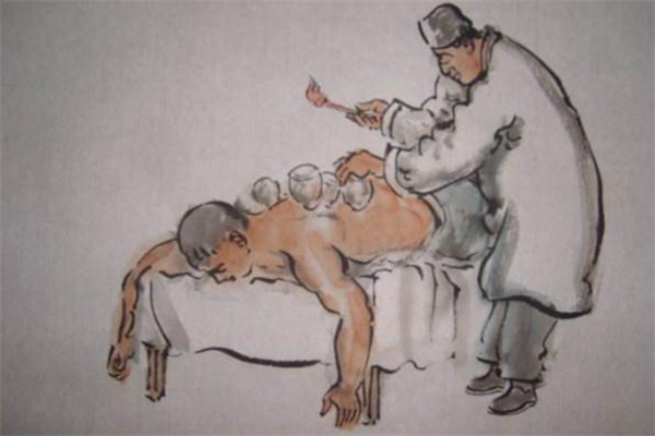 拔罐减肥什么季节最好,什么季节拔罐减肥效果好