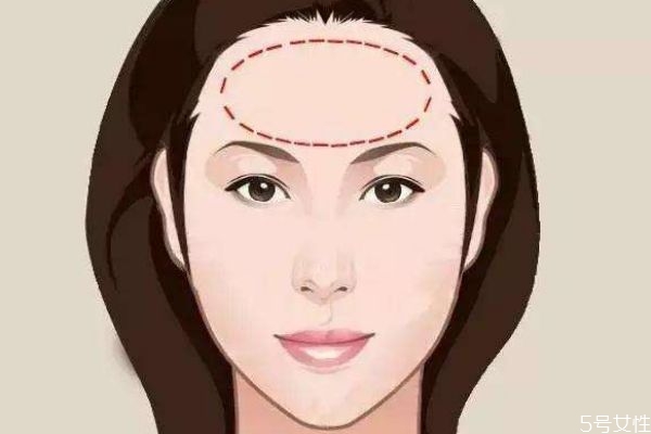 为什么会额头大,为什么有的人额头那么高