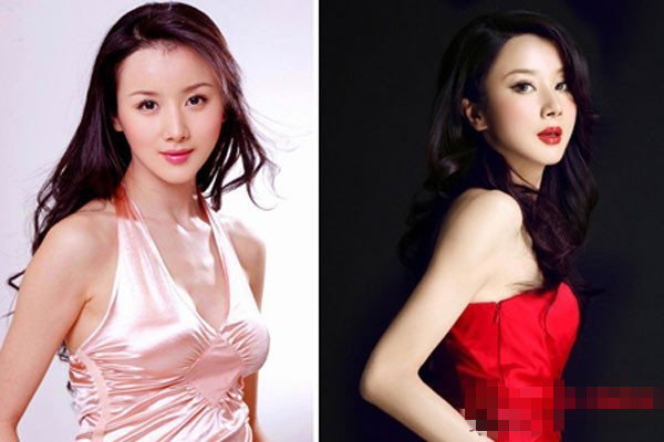 自体脂肪丰胸一次注射多少毫升,自体脂肪丰胸一次可以达到效果吗?