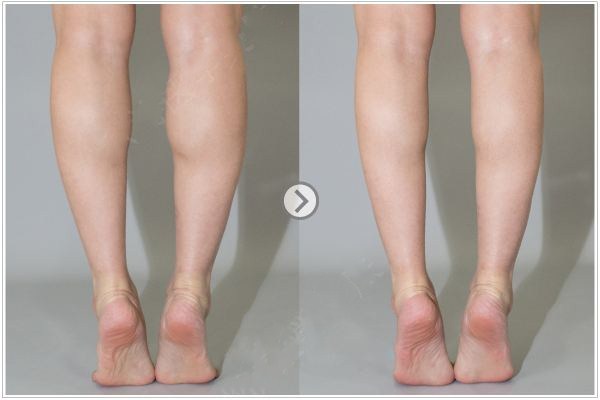 保鲜膜减肥有效果吗,保鲜膜能减肥吗?