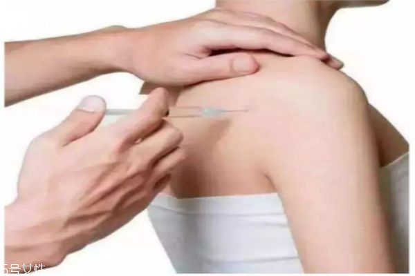 瘦肩针的副作用有哪些,瘦肩针的作用
