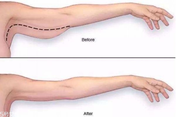 减肥小妙招快速瘦肚子方法,减肥小妙招大全最实用 减肥小妙招快速瘦肚子方法,减肥小妙招大全最实用