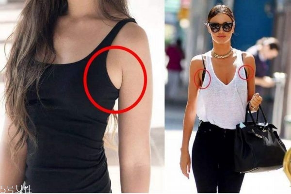 减副乳最快方法,怎样去除副乳最快方法 减副乳最快方法,怎样去除副乳最快方法