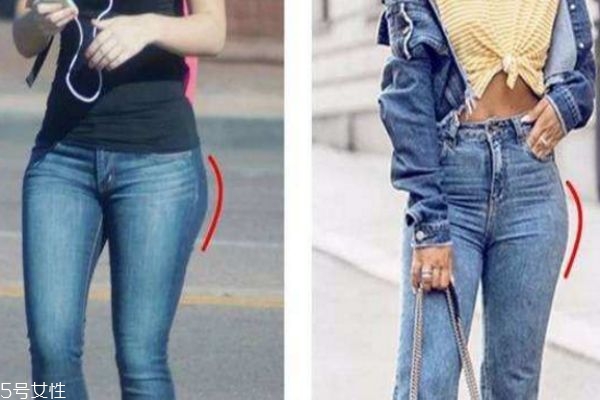 假胯宽多久能矫正过来,假胯宽多久可以矫正过来