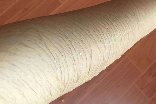 女生体毛旺盛的原因,女生体毛多是什么原因怎么解决