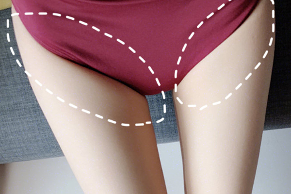 腹股沟位置图片,腹股沟在哪里位置图