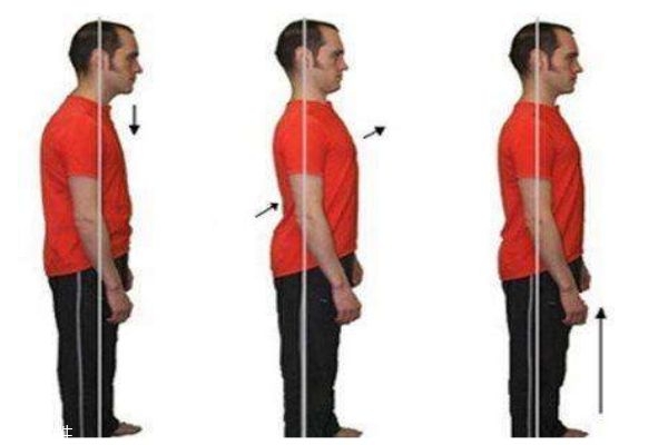 自测骨盆前倾方法,如何自查骨盆前倾