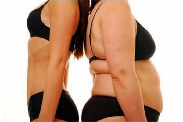 如何消除肥胖纹,怎样消除肥胖纹的方法如下