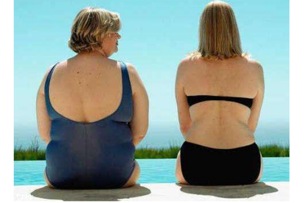 肥胖纹怎么形成原因,肥胖纹的形成