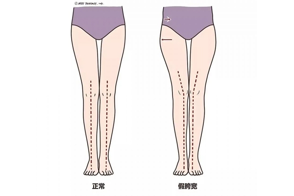 假胯宽怎么判断,如何确认自己是假胯宽