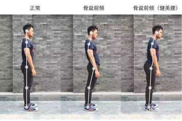 怎样改善骨盆前倾?,女性骨盆前倾的原因