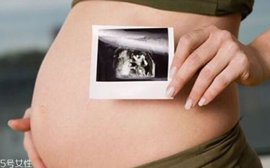 妈妈长妊娠纹女儿一定会长吗,有没有不长妊娠纹的孕妈妈 妈妈长妊娠纹女儿一定会长吗,有没有不长妊娠纹的孕妈妈